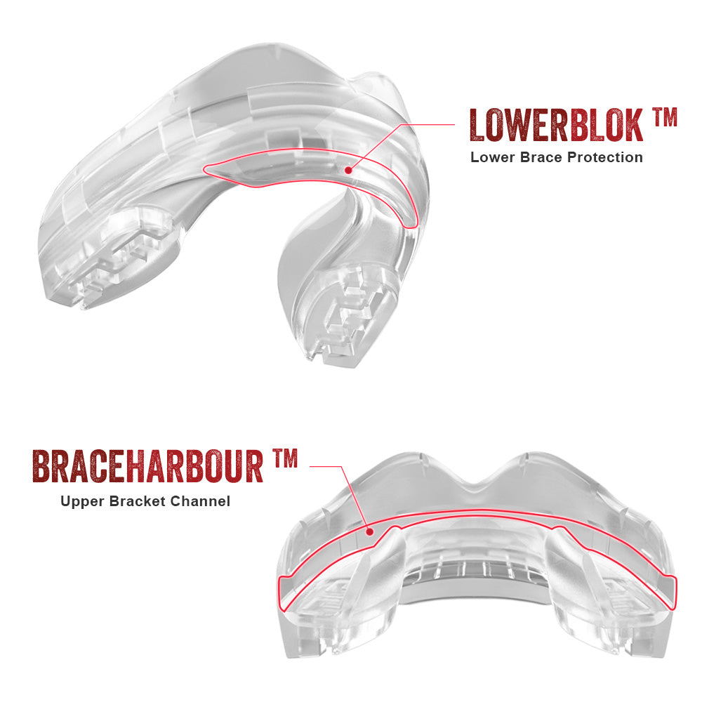 SAFEJAWZ® Ortho Series Mouthguard for Braces - Clear - SAFEJAWZ gum shield