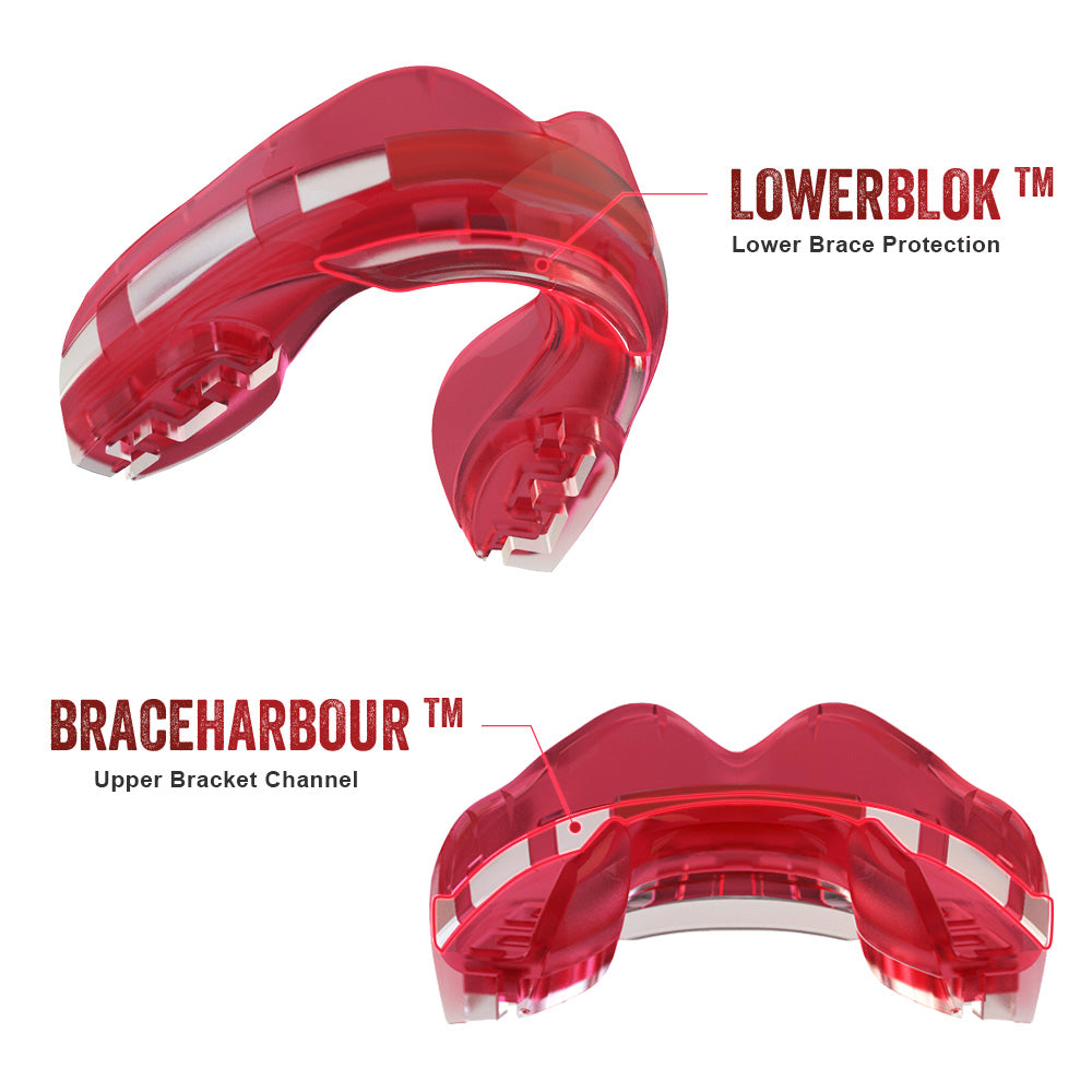 SAFEJAWZ® Ortho Series Mouthguard for Braces - Ice Pink - SAFEJAWZ gum shield